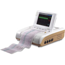 5.7 pouces moniteur foetal Doppler foetal maternelle moniteur échographie grand écran (SC-STAR5000E)
